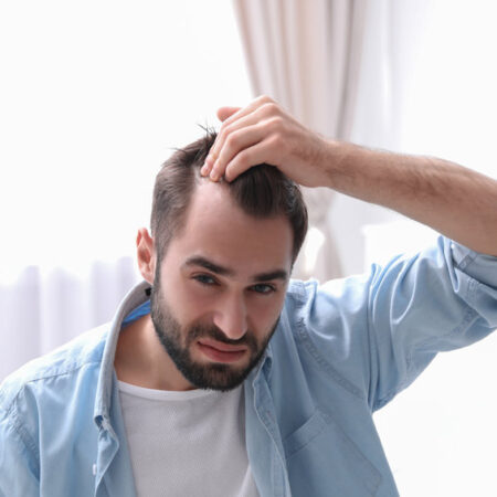 Zeg dag tegen bad hair days: zo vind je de beste haartransplantatiekliniek in Nederland 13