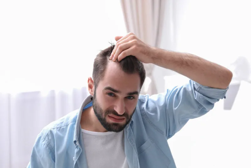 Zeg dag tegen bad hair days: zo vind je de beste haartransplantatiekliniek in Nederland 13